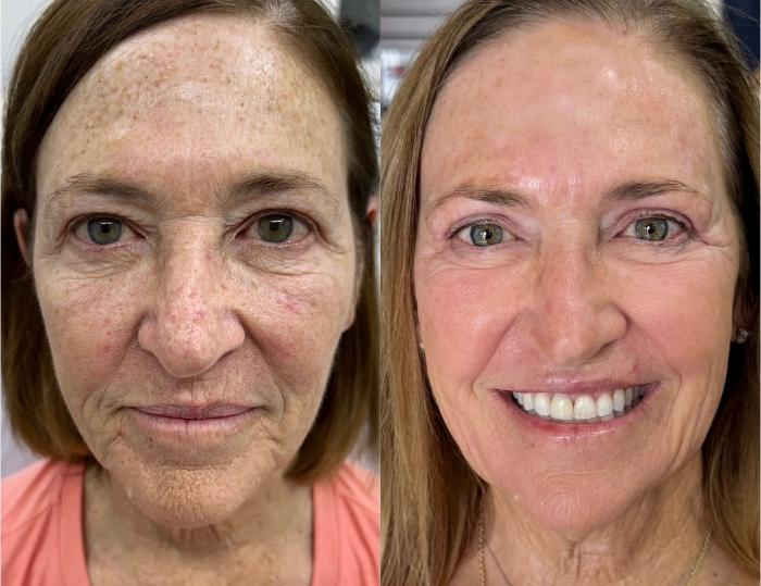The Ultimate Garden Glow Up