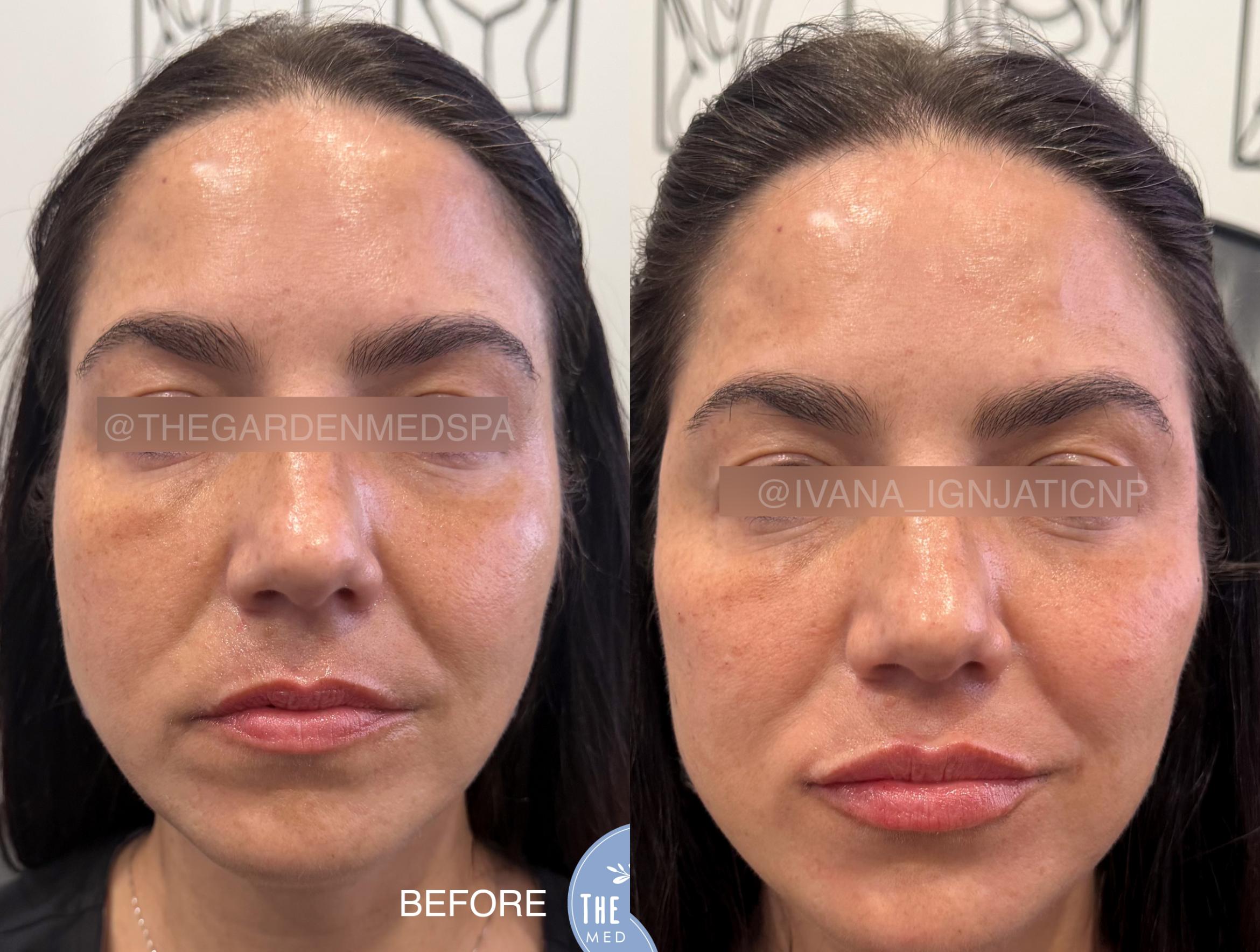 Full Facial Balancing 
