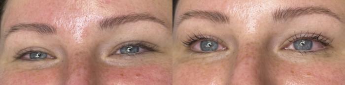 Before & After Lash Lift Client #48 Front View in Tampa Bay, North Palm Beach, FL