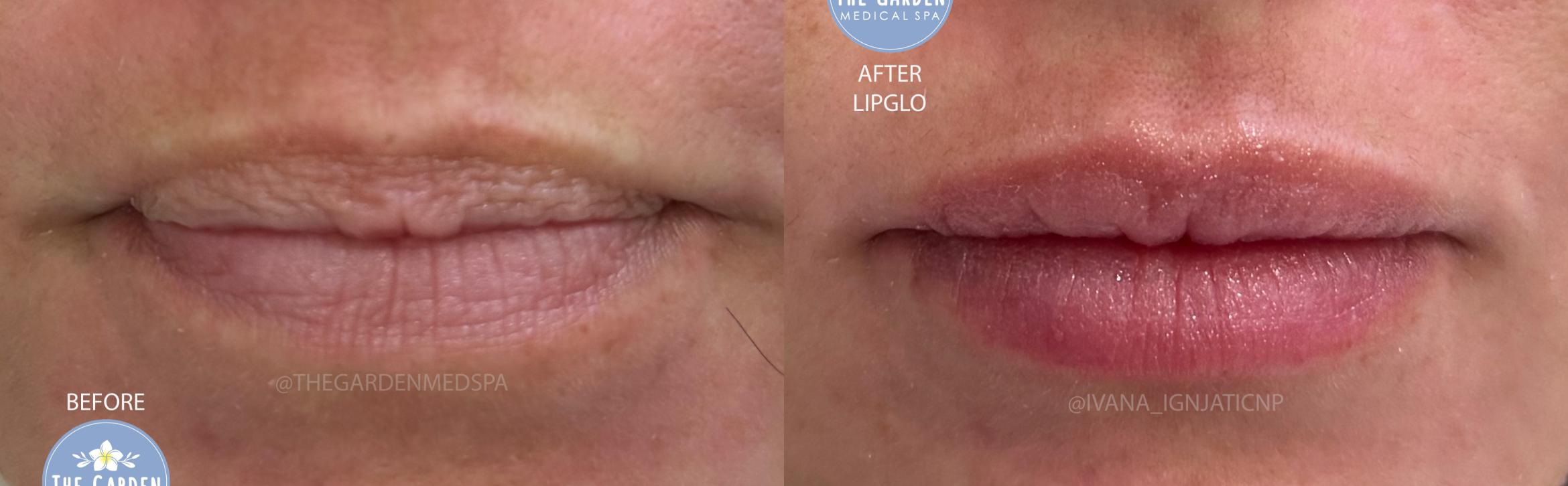 LipGlo for Lip Coloration & Hydration