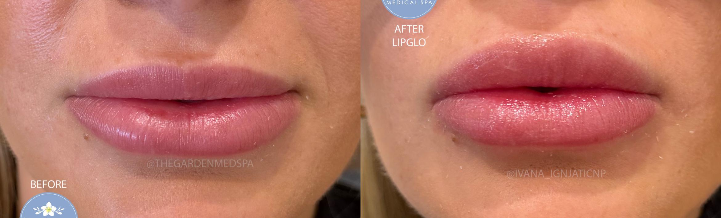 Instant Plump with LipGlo