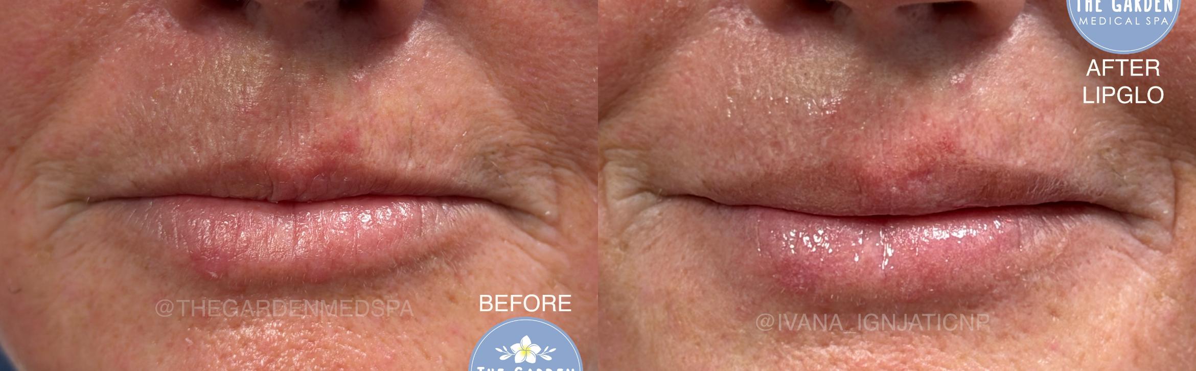 LipGlo for Subtle Enhancement
