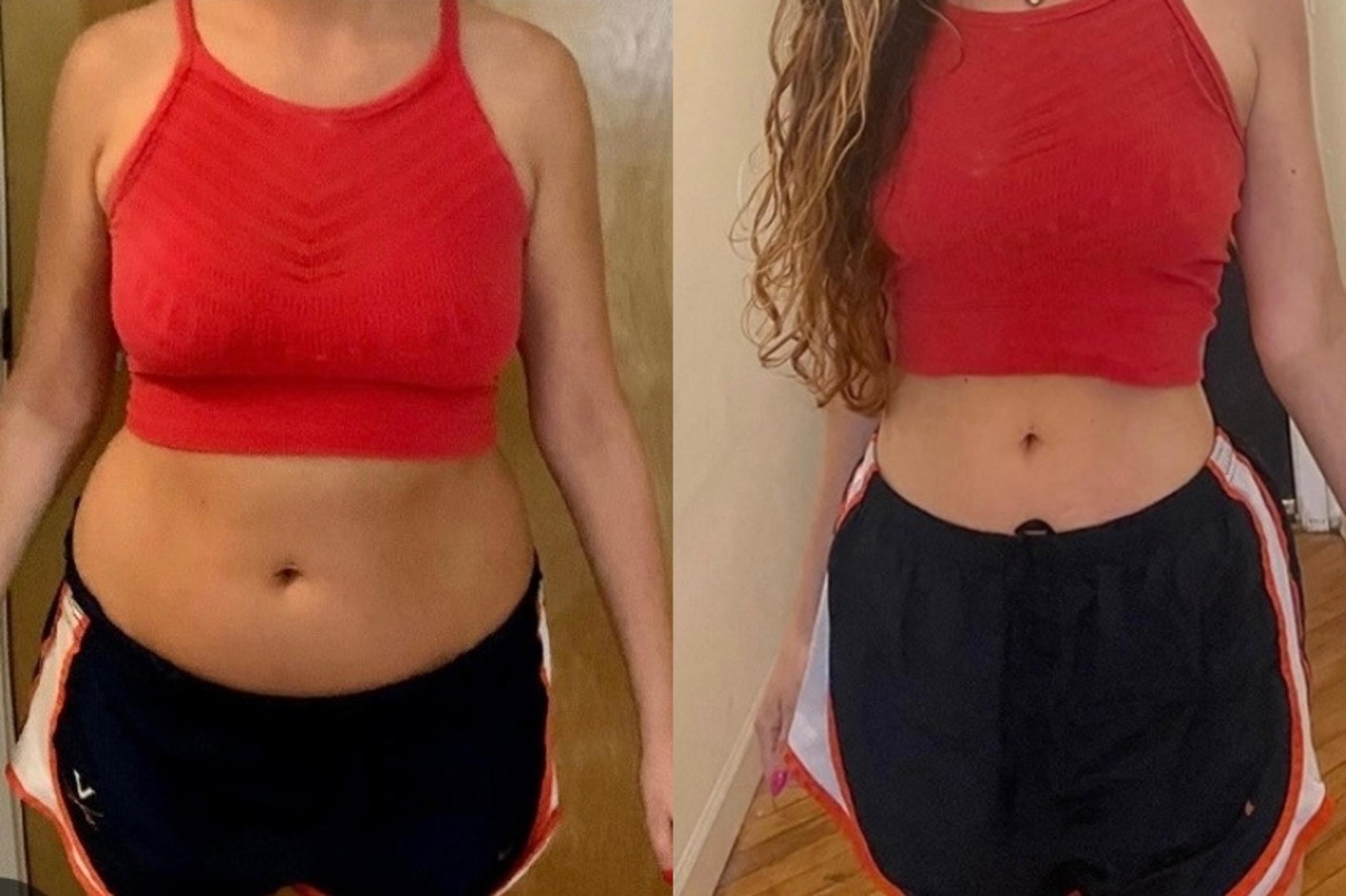 Before & After Weight Loss Client #156 Front View in Tampa Bay, North Palm Beach, FL