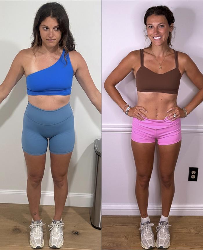 Before & After Weight Loss Client #195 Front View in Pinellas Park, Clearwater, St. Petersburg, North Palm Beach