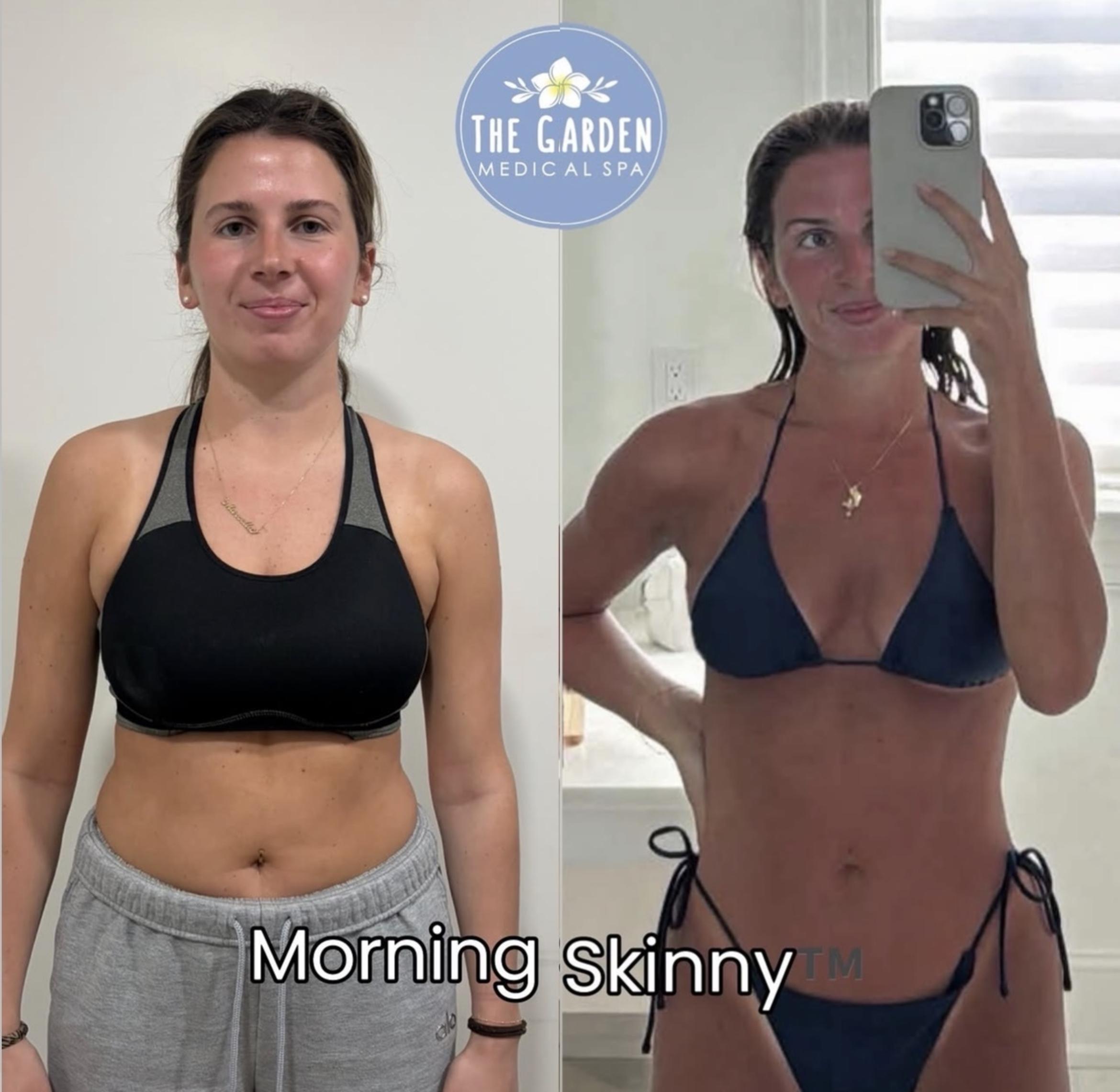 Morning Skinny